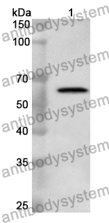 Anti-Langya virus/LayV N/Nucleocapsid protein Polyclonal Antibody